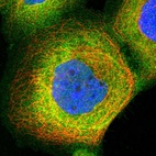 Immunofluorescent staining of human cell line A-431 shows localization to plasma membrane & cytosol.