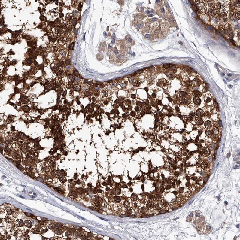 Anti-GAPVD1 Antibody