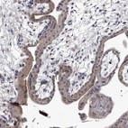 Anti-GAPVD1 Antibody