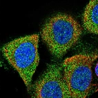 Immunofluorescent staining of human cell line A-431 shows localization to cytosol.