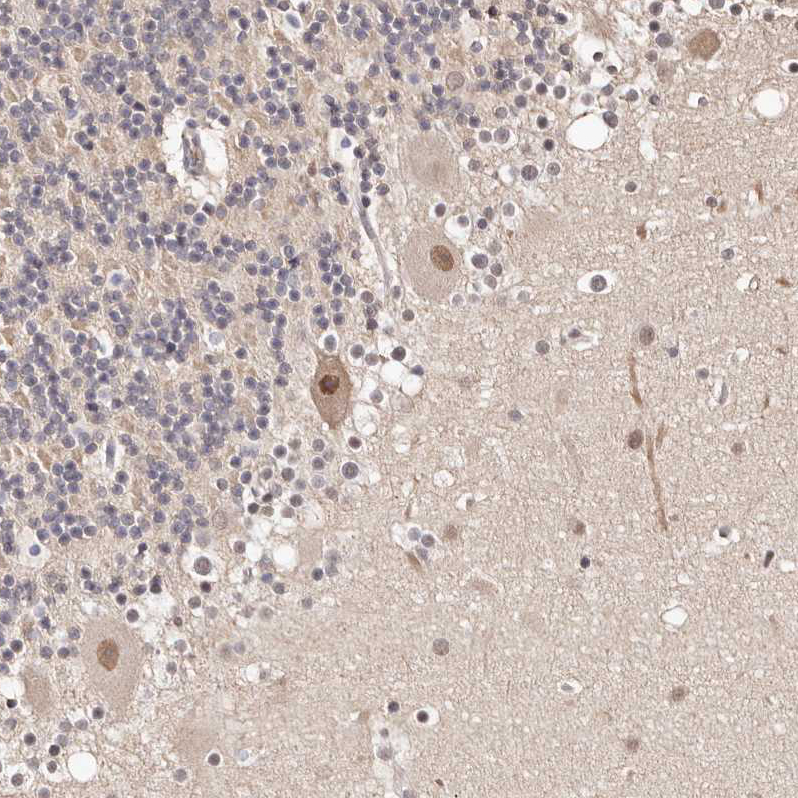 Anti-GLTSCR1L Antibody