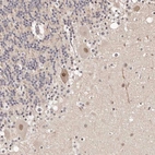 Anti-GLTSCR1L Antibody