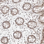 Immunohistochemical staining of human colon shows strong nuclear positivity in glandular cells.