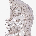 Immunohistochemical staining of human skin shows moderate nuclear positivity in squamous epithelial cells.