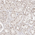 Immunohistochemical staining of human kidney shows moderate nuclear positivity in cells in tubules.