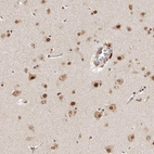 Anti-GLTSCR1L Antibody