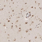 Anti-GLTSCR1L Antibody
