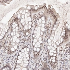 Immunohistochemical staining of human rectum shows moderate to strong nuclear positivity in glandular cells.