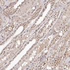Immunohistochemical staining of human kidney shows moderate nuclear positivity in cells in tubules.