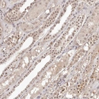 Immunohistochemical staining of human kidney shows moderate nuclear positivity in cells in tubules.
