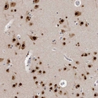 Anti-KHDRBS2 Antibody