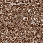 Anti-APLF Antibody