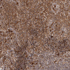Immunohistochemical staining of human tonsil shows moderate to strong cytoplasmic positivity in non - germinal center cells.