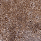 Immunohistochemical staining of human tonsil shows moderate to strong cytoplasmic positivity in non - germinal center cells.