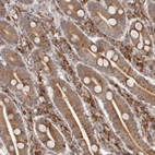 Immunohistochemical staining of human gastrointestinal shows moderate to strong cytoplasmic positivity in lymphoid cells.