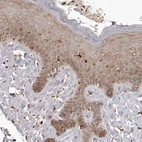 Immunohistochemical staining of human skin shows strong cytoplasmic positivity in Langerhans cells.
