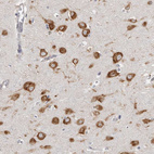 Anti-FAM167B Antibody