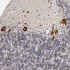 Immunohistochemical staining of human cerebellum shows strong cytoplasmic positivity in Purkinje cells.