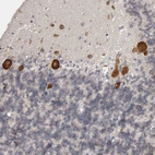 Immunohistochemical staining of human cerebellum shows strong cytoplasmic positivity in Purkinje cells.