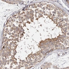 Immunohistochemical staining of human testis shows strong cytoplasmic positivity in cells in seminiferous ducts.