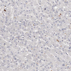 Immunohistochemical staining of human liver shows no positivity in hepatocytes as expected.