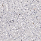 Immunohistochemical staining of human liver shows no positivity in hepatocytes as expected.