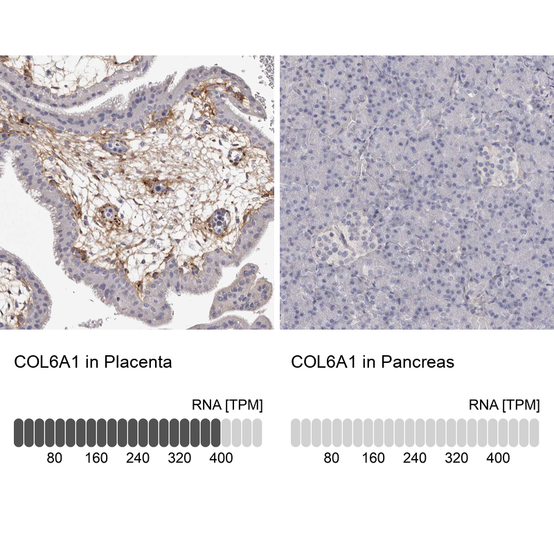Anti-COL6A1 Antibody