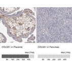 Anti-COL6A1 Antibody