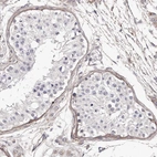 Immunohistochemical staining of human testis shows weak positivity in extracellular matrix in peritubular myoid cells.