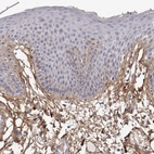 Immunohistochemical staining of human skin shows moderate positivity in extracellular matrix.
