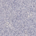 Immunohistochemical staining of human pancreas shows no positivity in exocrine glandular cells as expected.