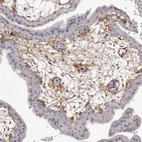Immunohistochemical staining of human placenta shows moderate positivity in extracellular matrix.
