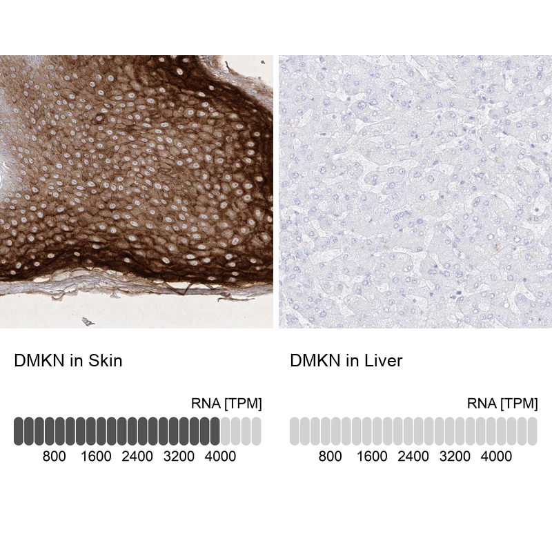 Anti-DMKN Antibody