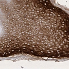 Immunohistochemical staining of human skin shows strong cytoplasmic positivity in squamous epithelial cells.