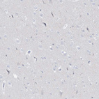 Immunohistochemical staining of human cerebral cortex shows no positivity in neurons as expected.