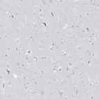 Immunohistochemical staining of human cerebral cortex shows no positivity in neurons as expected.