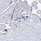 Immunohistochemical staining of human placenta shows no positivity in trophoblastic cells as expected.