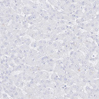 Anti-DMKN Antibody