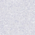 Immunohistochemical staining of human liver shows no positivity in hepatocytes as expected.