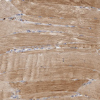 Anti-FAM189A2 Antibody