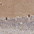 Immunohistochemical staining of human cerebellum shows strong cytoplasmic positivity in Purkinje cells as well as staining in the molecular layer.