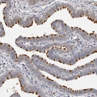 Immunohistochemical staining of human fallopian tube shows strong positivity in cilia in glandular cells.