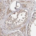 Immunohistochemical staining of human testis shows moderate cytoplasmic positivity in cells in seminiferous ducts.