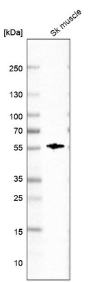 Western blot analysis in human skeletal muscle tissue.