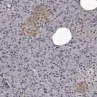 Anti-DHPS Antibody