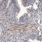 Immunohistochemical staining of human prostate shows moderate cytoplasmic positivity in smooth muscle cells.