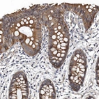 Immunohistochemical staining of human colon shows moderate cytoplasmic positivity in glandular cells.