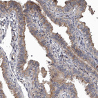 Immunohistochemical staining of human fallopian tube shows moderate cytoplasmic/membranous positivity in glandular cells.