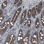 Immunohistochemical staining of human duodenum shows strong cytoplasmic positivity in glandular cells.
