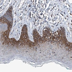 Immunohistochemical staining of human skin shows strong cytoplasmic positivity in squamous epithelial cells in the suprabasal layer.